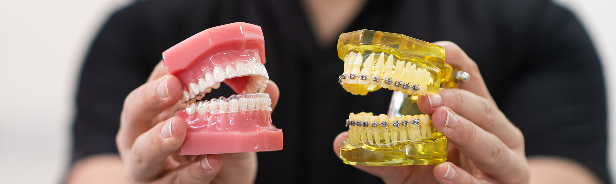 Clear Aligners vs. Braces: Which Orthodontic Treatment is Right for You?