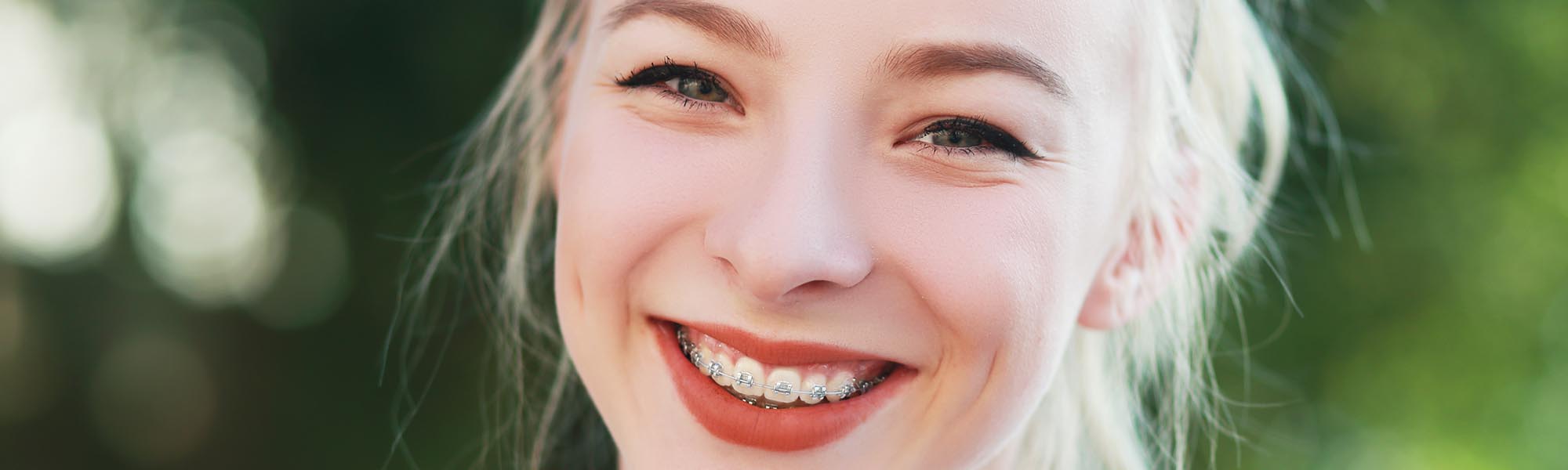 What to Do in an Orthodontic Emergency on Vacation Santa Barbara CA Banner