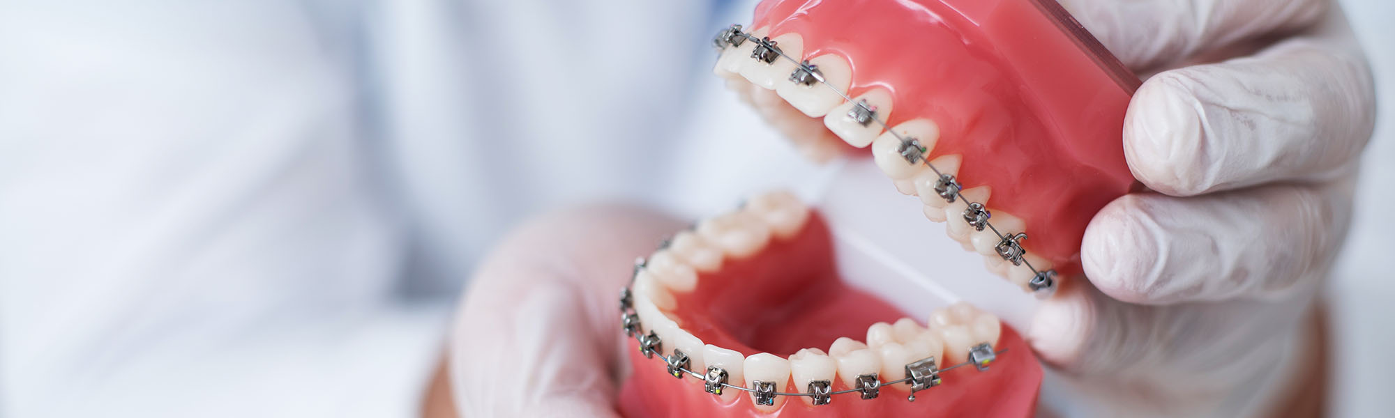 Why Straighten Teeth