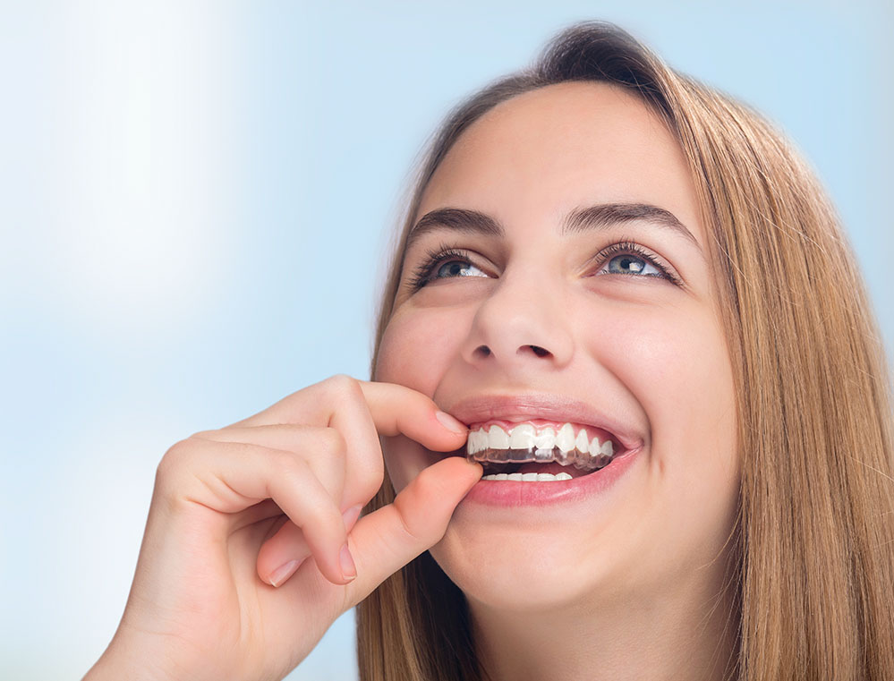  Invisalign Santa Barbara CA